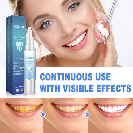 Teeth Repair Gel